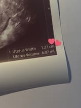 1731057043721394