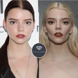 buccal