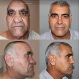 modern plastic surgery