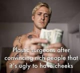 buccal fat removal meme