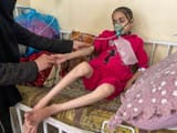 202404mena_palestine_gaza_n_malnutrition