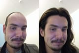 haarmaxxen