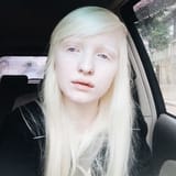 albino