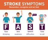 stroke-symptoms