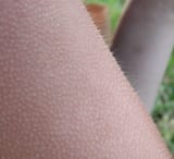 1024px-2003-09-17_Goose_bumps
