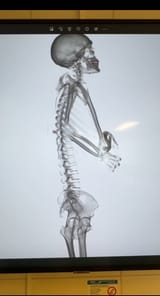 Mr_Skeltal