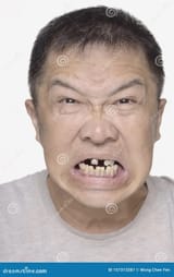 chinaman bad teeth