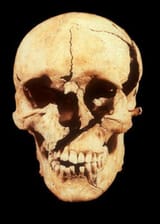 Skull Age
