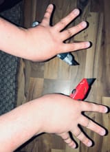 chkn foot