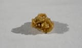 Kidney_stone