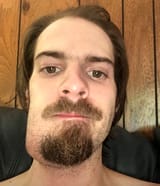 chad abscess vs virgin healthy tooth