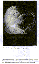 Xray