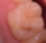 PXL_20250611_201806647~2