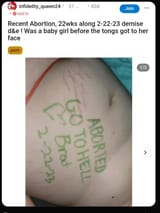 pro-choice