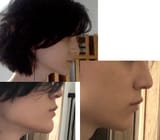 side profile