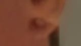 belly button