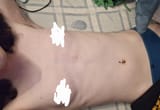 1000022632