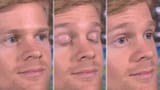 Blinking_White_Guy_meme_banner