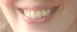 smile