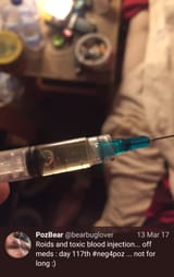 pozzed blood injection