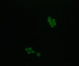 W25_S2_CM_SM_VJ_ML_H3_GFP1