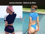 james-charles-bbl-before-afterr