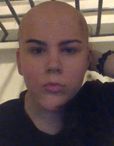 bald