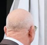 wigless