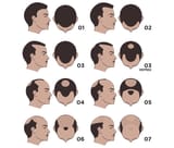 A4F6FF5B-E924-400A-89AA-76CFCBB7D57D