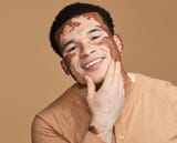 Vitiligo-Male-Model-USA-Curtis-M