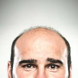 2129-bald_male-500x500-small_widget