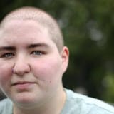 bald