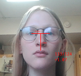 midface