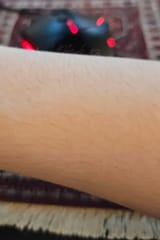 arm hair