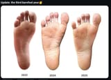 how feet should look
