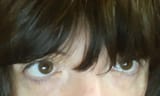 eyebags