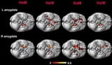 Hetero vs Homosexual Amygdala Activity