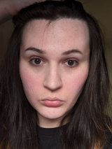 pichu hairline