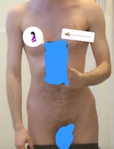 1000000860