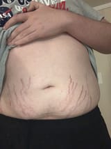 just fucking kill me 1