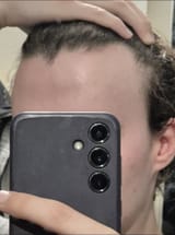 1000054104