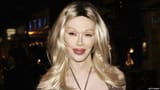 _92079385_burns_getty1