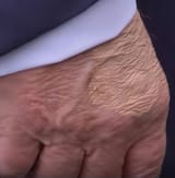 sicktrump