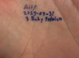 Hand