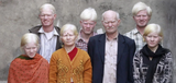 Albino Indians