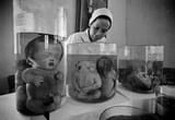 victims-of-agent-orange-from-the-vietnam-war-v0-7y7b0i25zydd1
