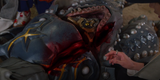 Wound