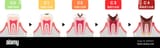 the-stages-of-tooth-decay-flat-vector-illustration-japanese-2BPWG7A