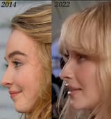 sabrina carpenter before after
