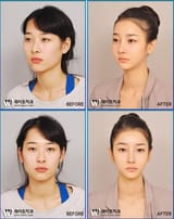 1609492576144 before and after